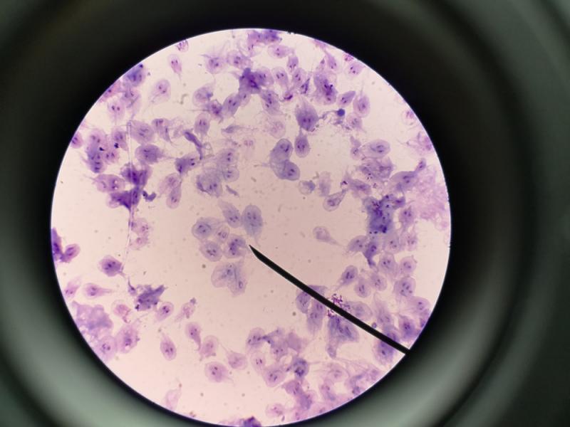 Giardia